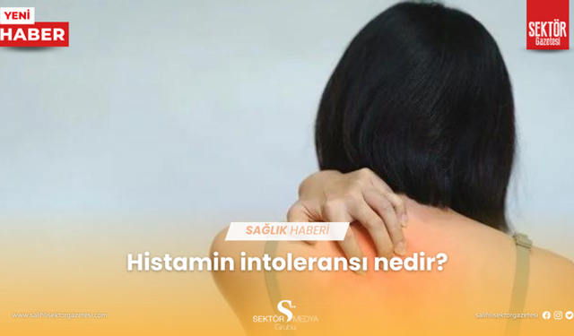 Histamin intoleransı nedir?